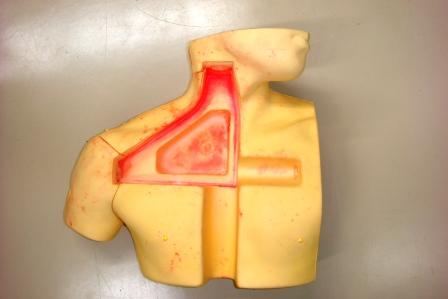 【中心静脈カテーテル挿入】CVC挿入シミュレータ（ボディーのみ）