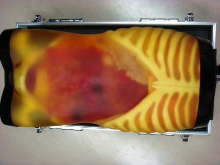 【超音波診断】外傷・救急用超音波診断トレーニングファントム　FAST/ER FAN