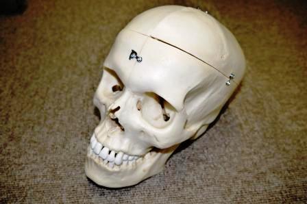 【人体模型】頭蓋　高精度型６分解コンプリートモデル