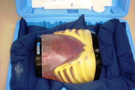 【超音波診断】超音波診断ファントム上腹部病変付モデル　ABDFAN