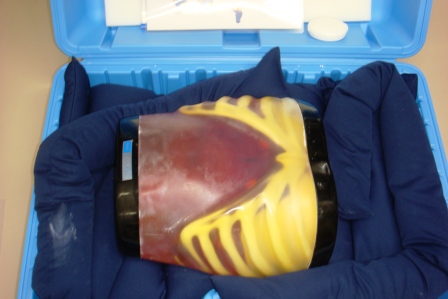 【超音波診断】超音波診断ファントム上腹部モデル　ECHOZY